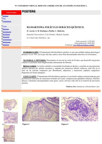 hamartoma folÃ­culo sebÃ¡ceo quÃ­stico. - V Congreso Virtual ...