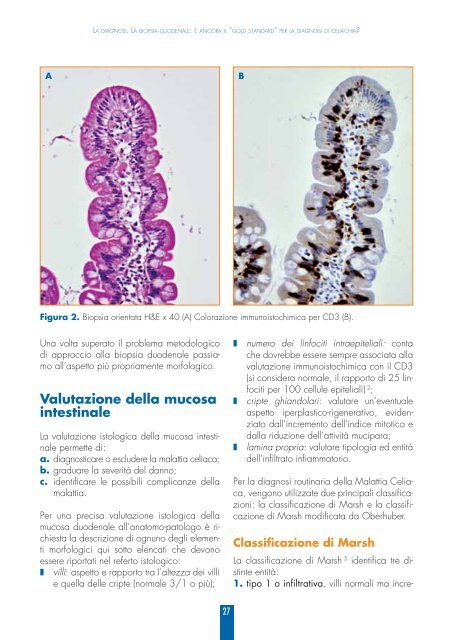 la malattia celiaca in medicina generale - Associazione Italiana ...