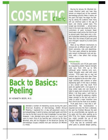 Back to Basics: Peeling - West Palm Beach Dermatologist