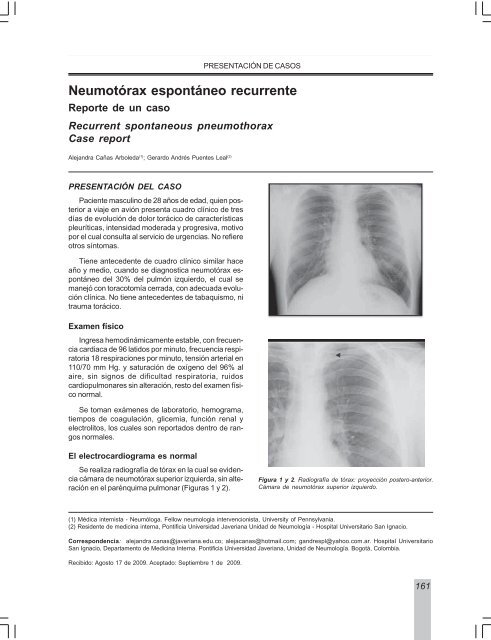 NeumotÃ³rax espontÃ¡neo recurrente - Asoneumocito