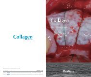 Collagen Membrane - Dentium