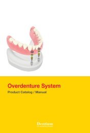 Overdenture System