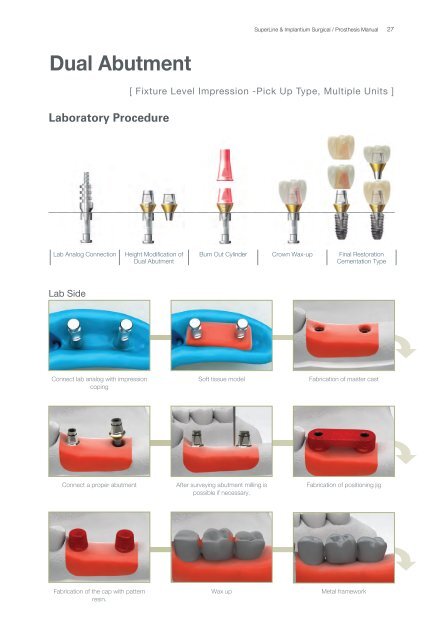 Dual Abutment