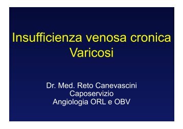 Insufficienza venosa cronica Varicosi - L'eco della SUMSI