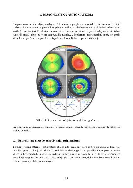 Seka Džambazovski Alorić - Astigmatizam - Departman za fiziku ...