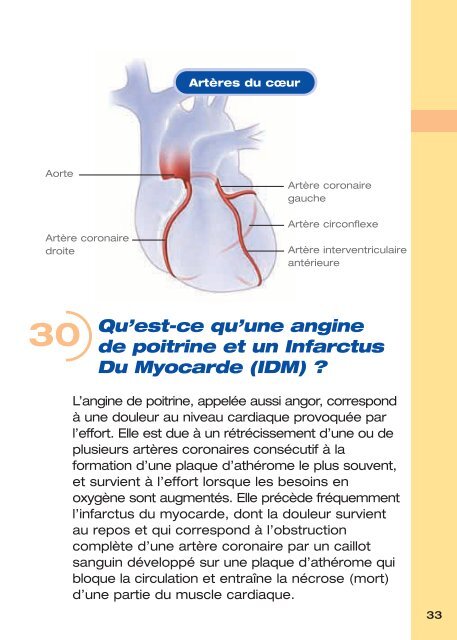 (AOMI) : 101 Questions-RÃ©ponses - PrÃ©vention des Risques ...