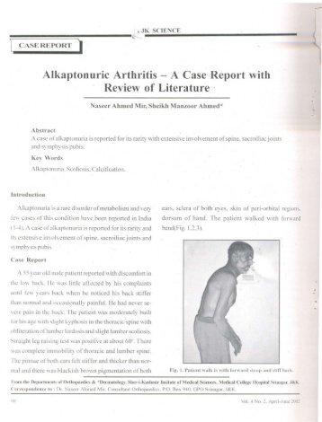 Alkaptonuric Arthritis - A Case Report with Review of ... - JK Science