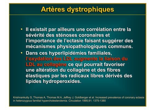 Artères dystrophiques - Mediathèque du congrès de High Tech Cardio