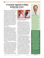 A Systematic Approach to Fitting Keratoconus Lenses