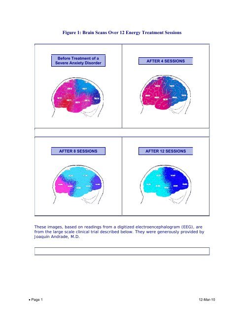 Figure 1: Brain Scans Over 12 Energy Treatment Sessions