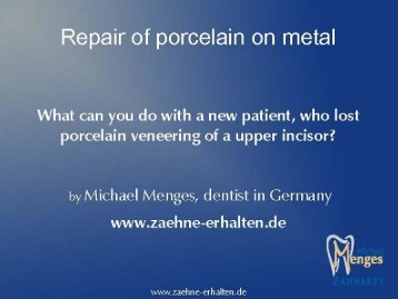 Repair of Porcelain on metal using Siljet.pdf - Danville Materials