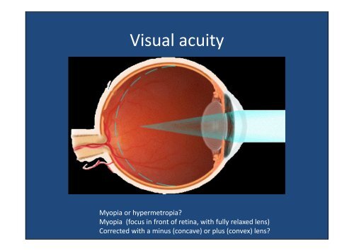 Aviation ophthalmology