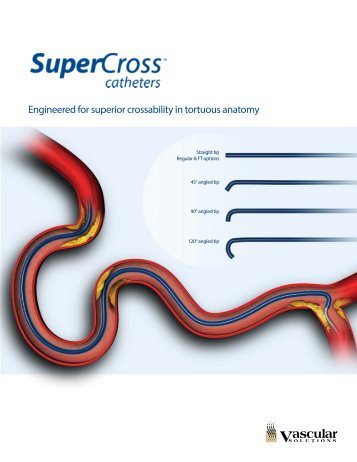 SuperCross Brochure - Vascular Solutions, Inc.