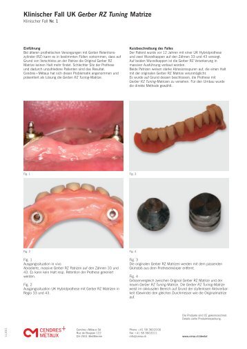 Klinischer Fall UK Gerber RZ Tuning Matrize - Cendres & Métaux SA