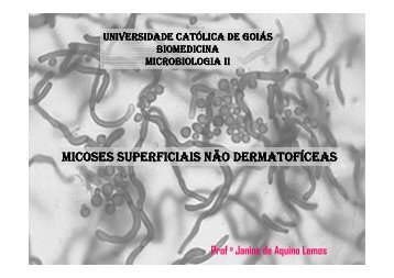 Micoses superficiais nao dermatoficeas 2008.pdf - Ucg