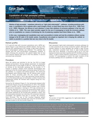 Case Study - Medtronic CryoCath LP