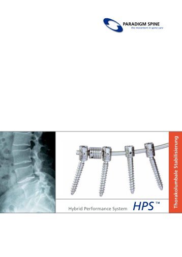 HPS™ Broschüre Deutsch.pdf - Paradigm Spine