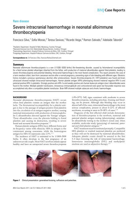 Severe intracranial haemorrhage in neonatal alloimmune ... - RIHUC