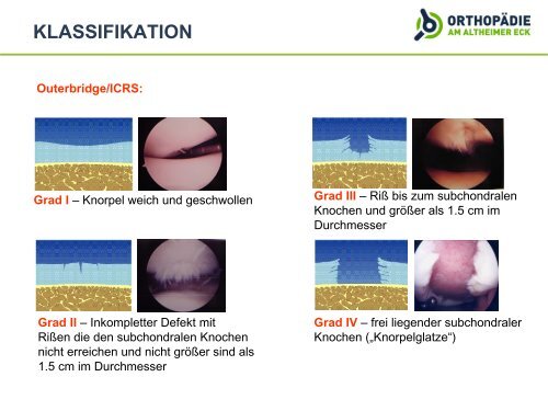 KnorpelschÃ¤den an Knie- und Sprunggelenk - Rotkreuzklinikum ...