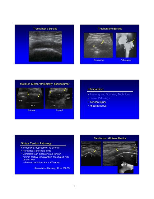 jacobson glut tendon 8-23-12 syllabus