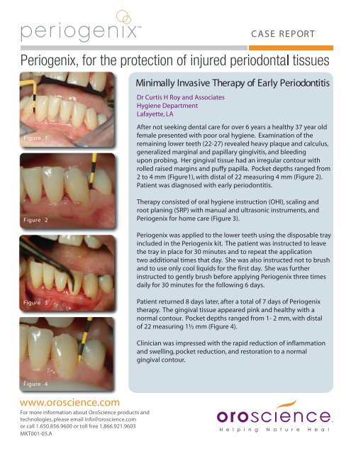 歯周治療プラクティスマニュアル = Periodontal therapy :… 61PV-sEiI+L.jpg