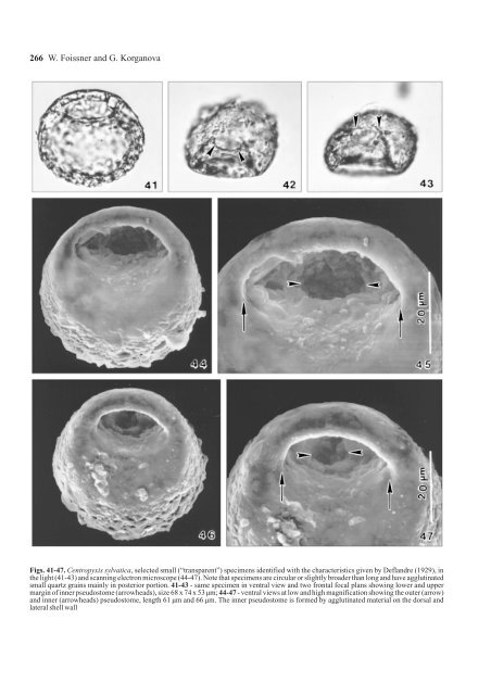 The Centropyxis aerophila Complex (Protozoa: Testacea)