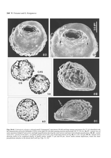 The Centropyxis aerophila Complex (Protozoa: Testacea)