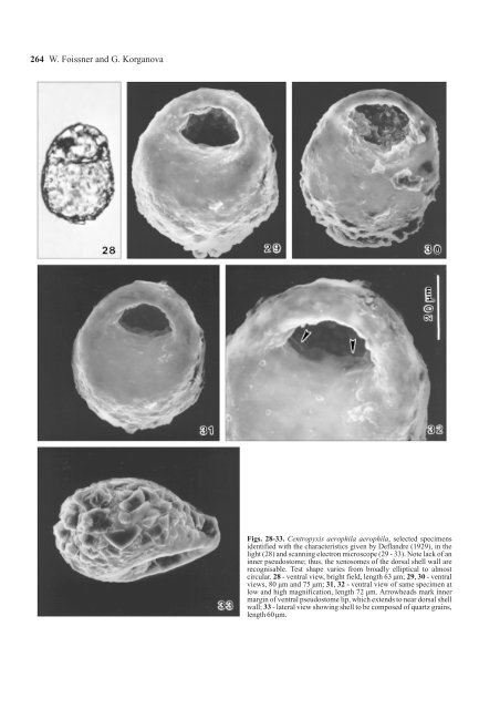 The Centropyxis aerophila Complex (Protozoa: Testacea)