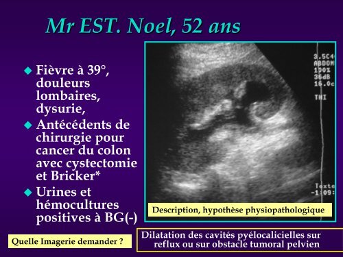 RADIOLOGIE EN PATHOLOGIE INFECTIEUSE