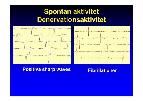 Metoder och indikationer