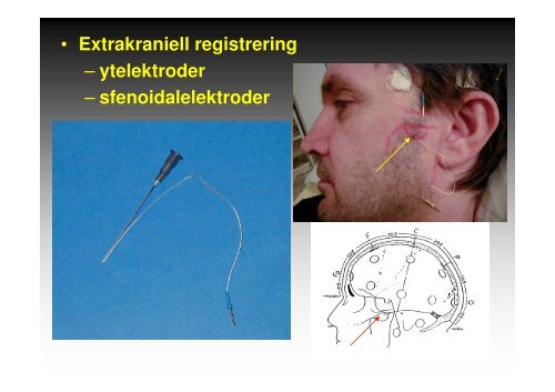 Metoder och indikationer