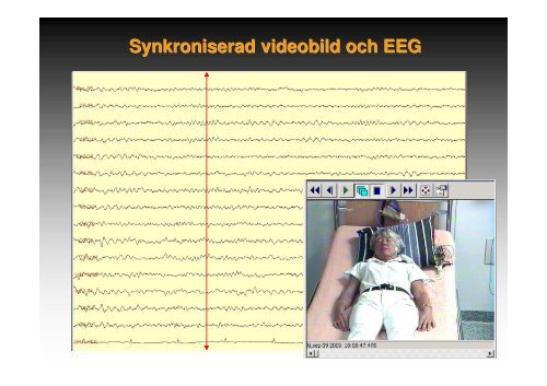 Metoder och indikationer