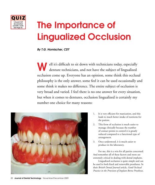 The Importance of Lingualized Occlusion - JDT Unbound