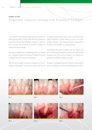 Single-tooth recession coverage with StraumannÂ® Emdogain