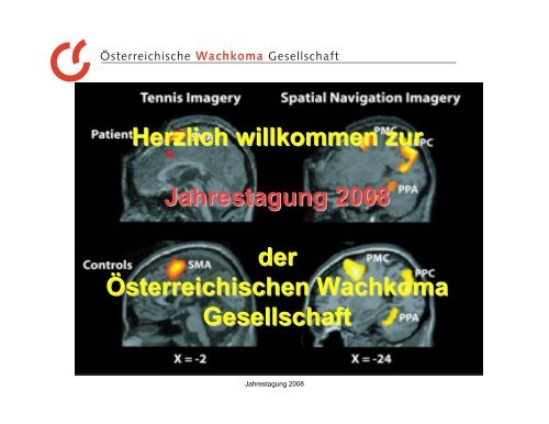 Download als pdf-Datei: 1.560 KB - Ãsterreichische Wachkoma ...