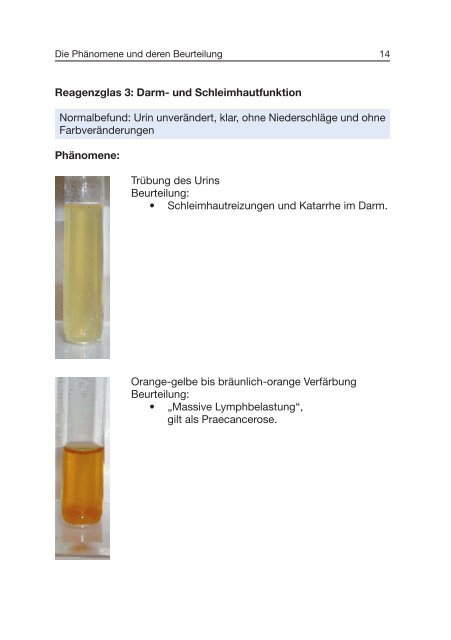 Traditionelle Urinfunktionsdiagnostik - ISO-Arzneimittel