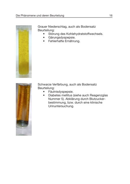 Traditionelle Urinfunktionsdiagnostik - ISO-Arzneimittel