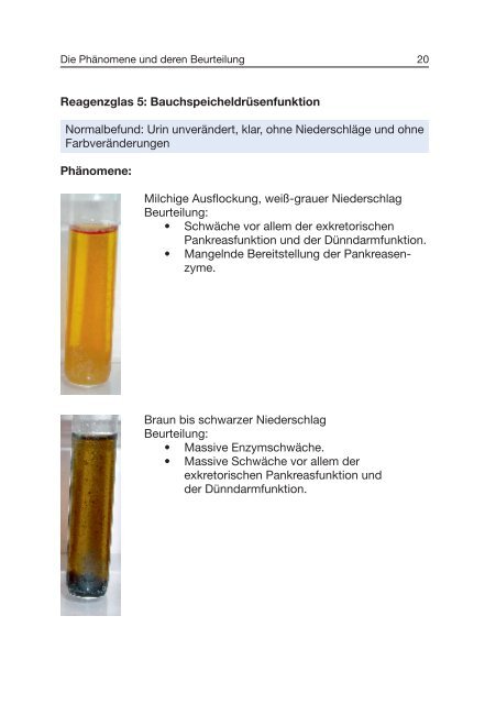 Traditionelle Urinfunktionsdiagnostik - ISO-Arzneimittel