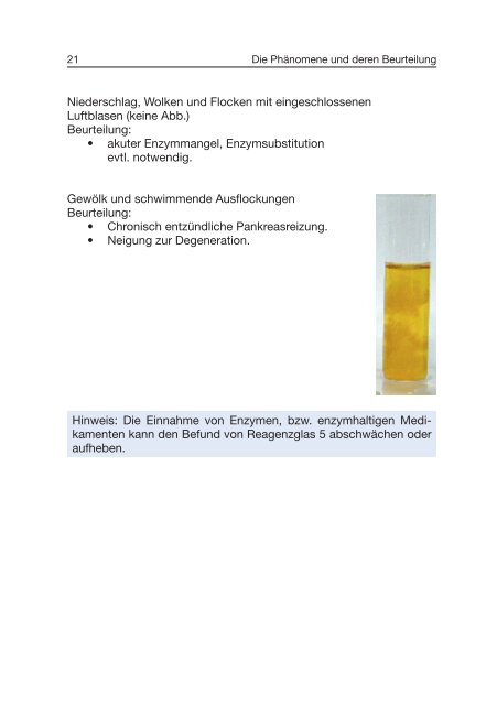 Traditionelle Urinfunktionsdiagnostik - ISO-Arzneimittel