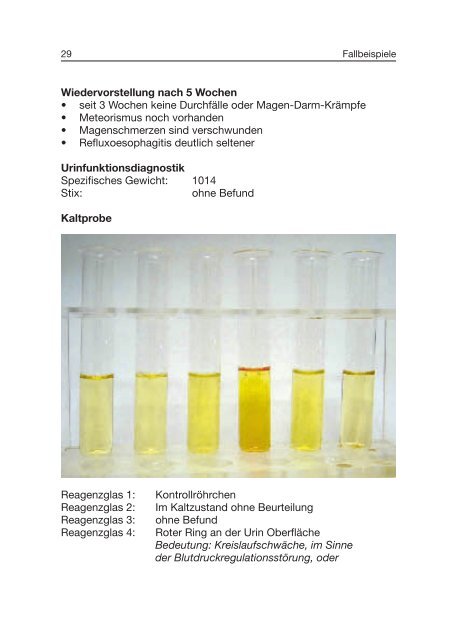 Traditionelle Urinfunktionsdiagnostik - ISO-Arzneimittel