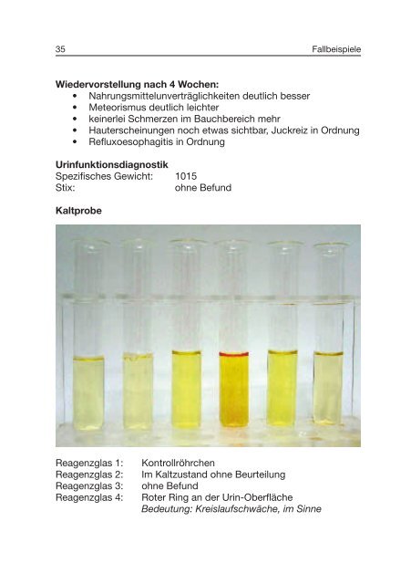 Traditionelle Urinfunktionsdiagnostik - ISO-Arzneimittel