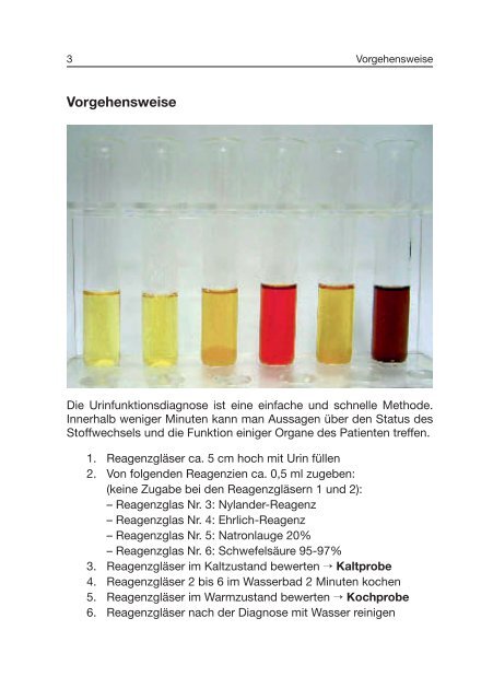 Traditionelle Urinfunktionsdiagnostik - ISO-Arzneimittel