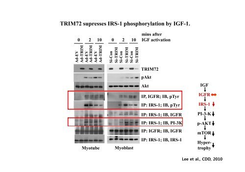 E3 ligase TRIM72 negatively regulates myogenesis by IRS-1 ...