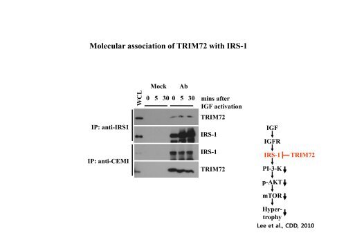 E3 ligase TRIM72 negatively regulates myogenesis by IRS-1 ...