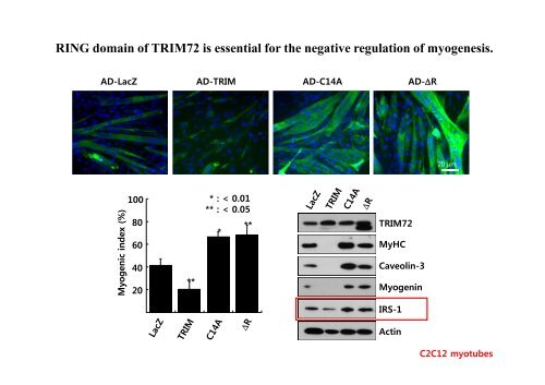 E3 ligase TRIM72 negatively regulates myogenesis by IRS-1 ...