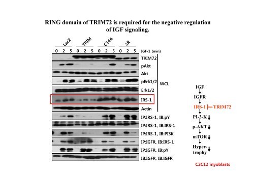 E3 ligase TRIM72 negatively regulates myogenesis by IRS-1 ...