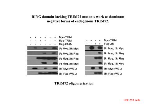 E3 ligase TRIM72 negatively regulates myogenesis by IRS-1 ...