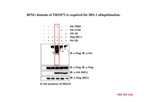 E3 ligase TRIM72 negatively regulates myogenesis by IRS-1 ...