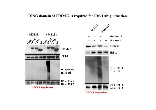 E3 ligase TRIM72 negatively regulates myogenesis by IRS-1 ...