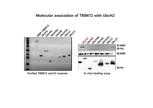 E3 ligase TRIM72 negatively regulates myogenesis by IRS-1 ...